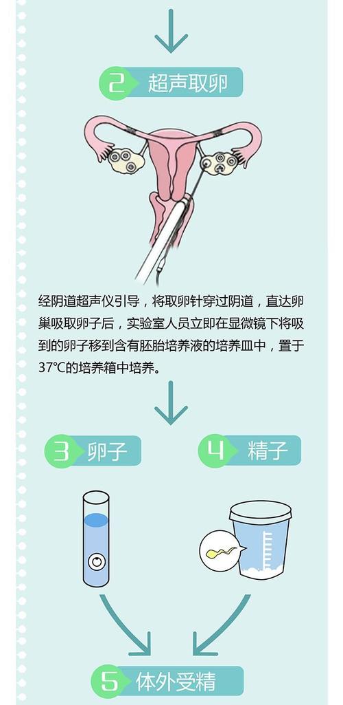 借卵试管流程【借卵试管流程解析及注意事项】